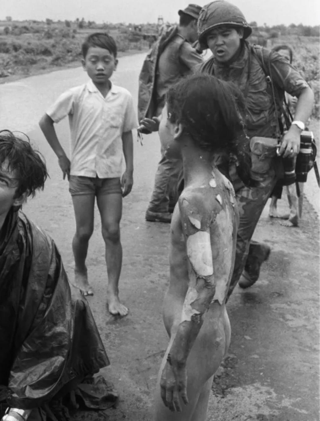 Napalm victims 