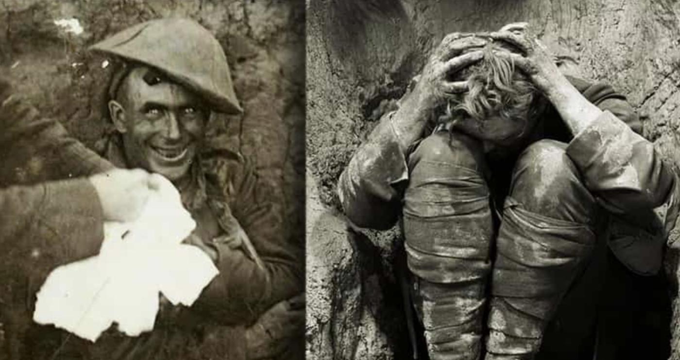 Shell shock victims ww1