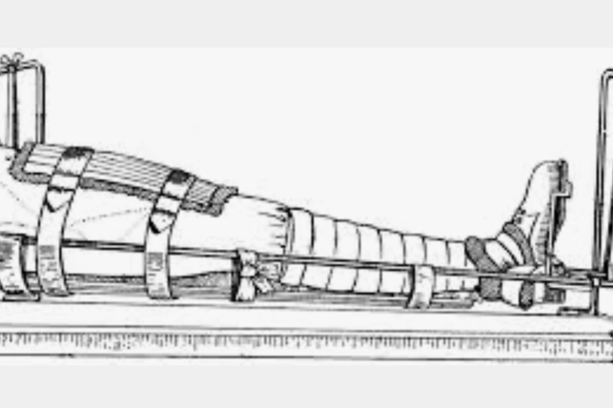 Thomas splint military medical treatment 