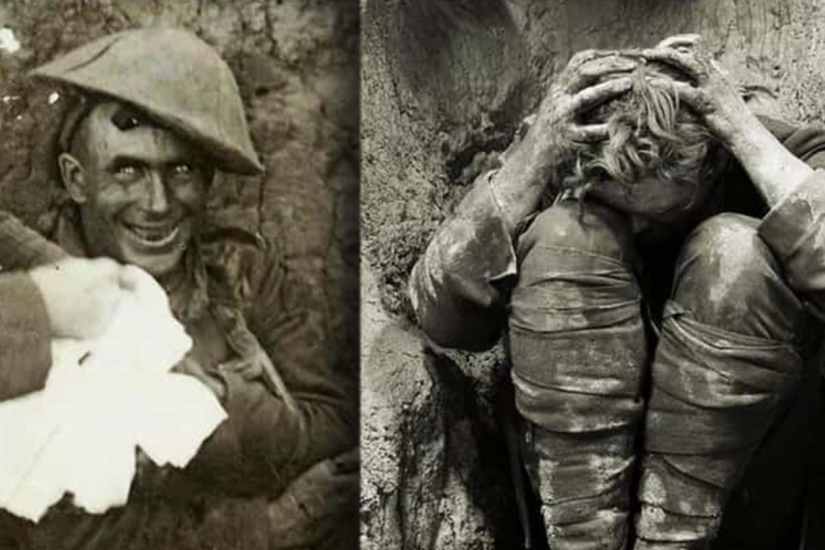 Shell shock victims ww1